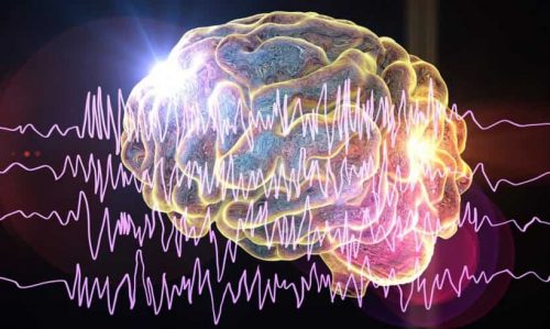 Cirugía Cerebral en Epilepsia refractaria en Neurocirugía Almenara Peru